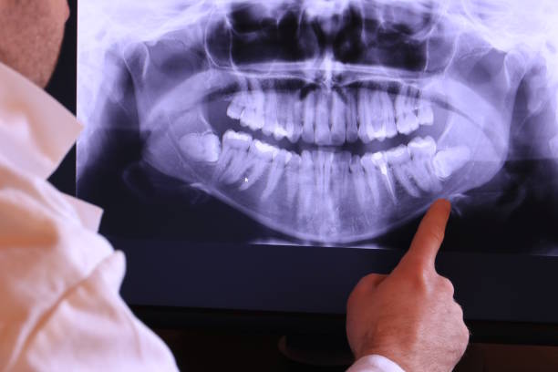 Best Same-Day Emergency Dentist in Reidsville, NC