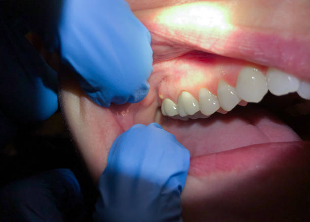 Best Pediatric Emergency Dentist in Reidsville, NC