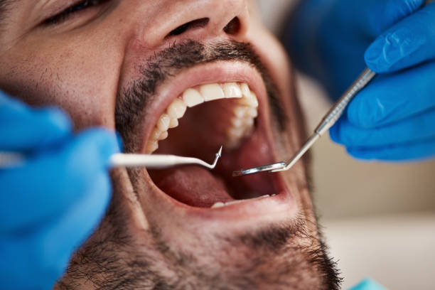 Best Emergency Dental Care for Trauma or Injury in Reidsville, NC